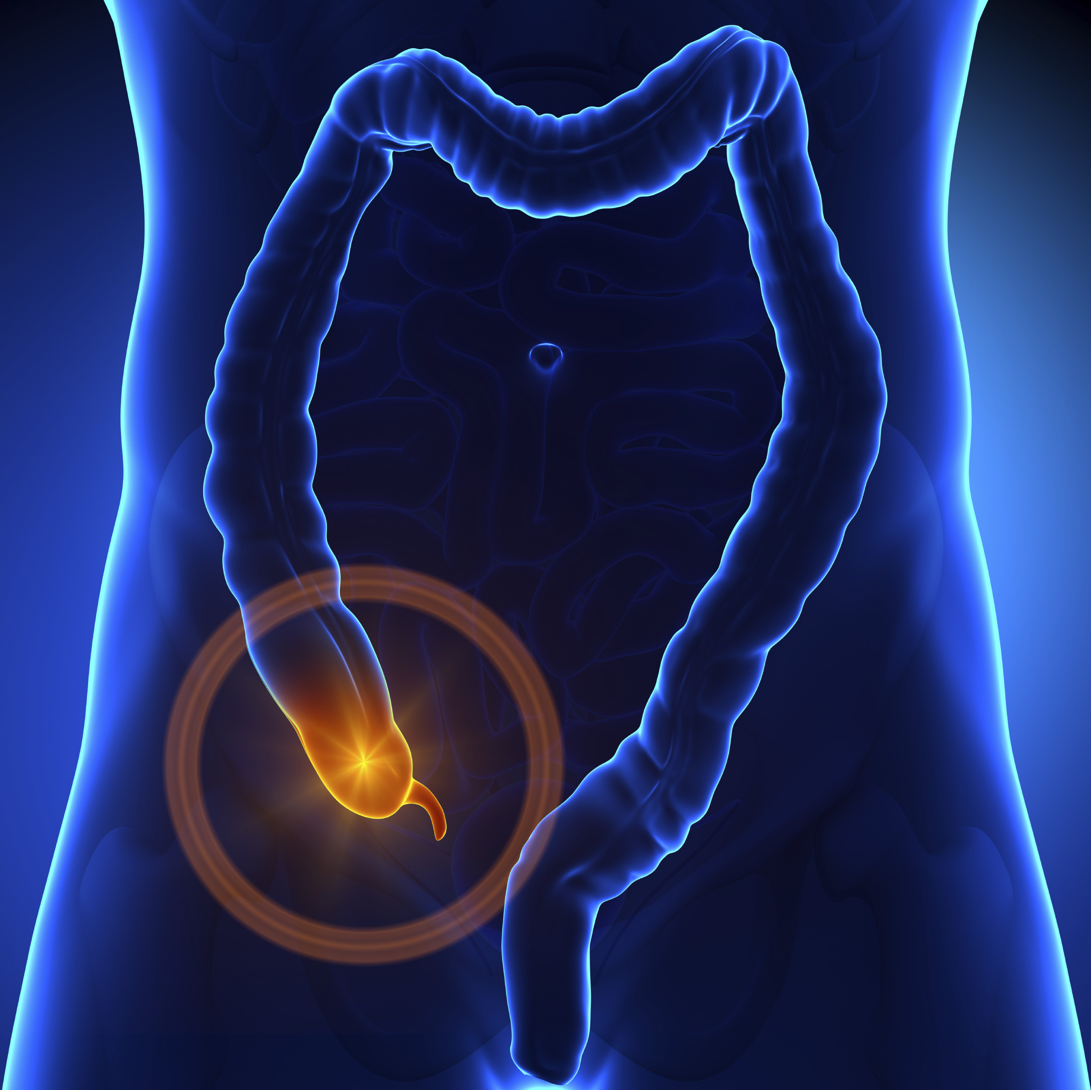 Learn about Appendicitis- Risk factors, Symptoms, Test and Diagnosis